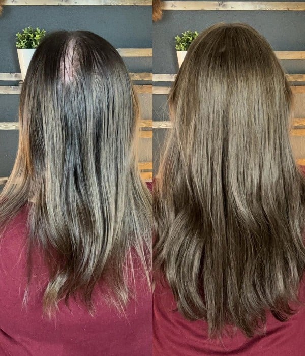 Aplique Topo De Cabeça (Cabelo Humano) - Para Alopecia, Falhas, Cabelos Ralos e com Queda