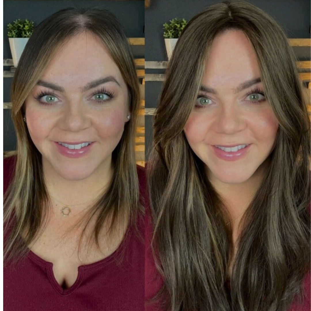 Aplique Topo de Cabeça - Fibra Orgânica (Para Alopecia, Falhas, Cabelos Ralos e com Queda)