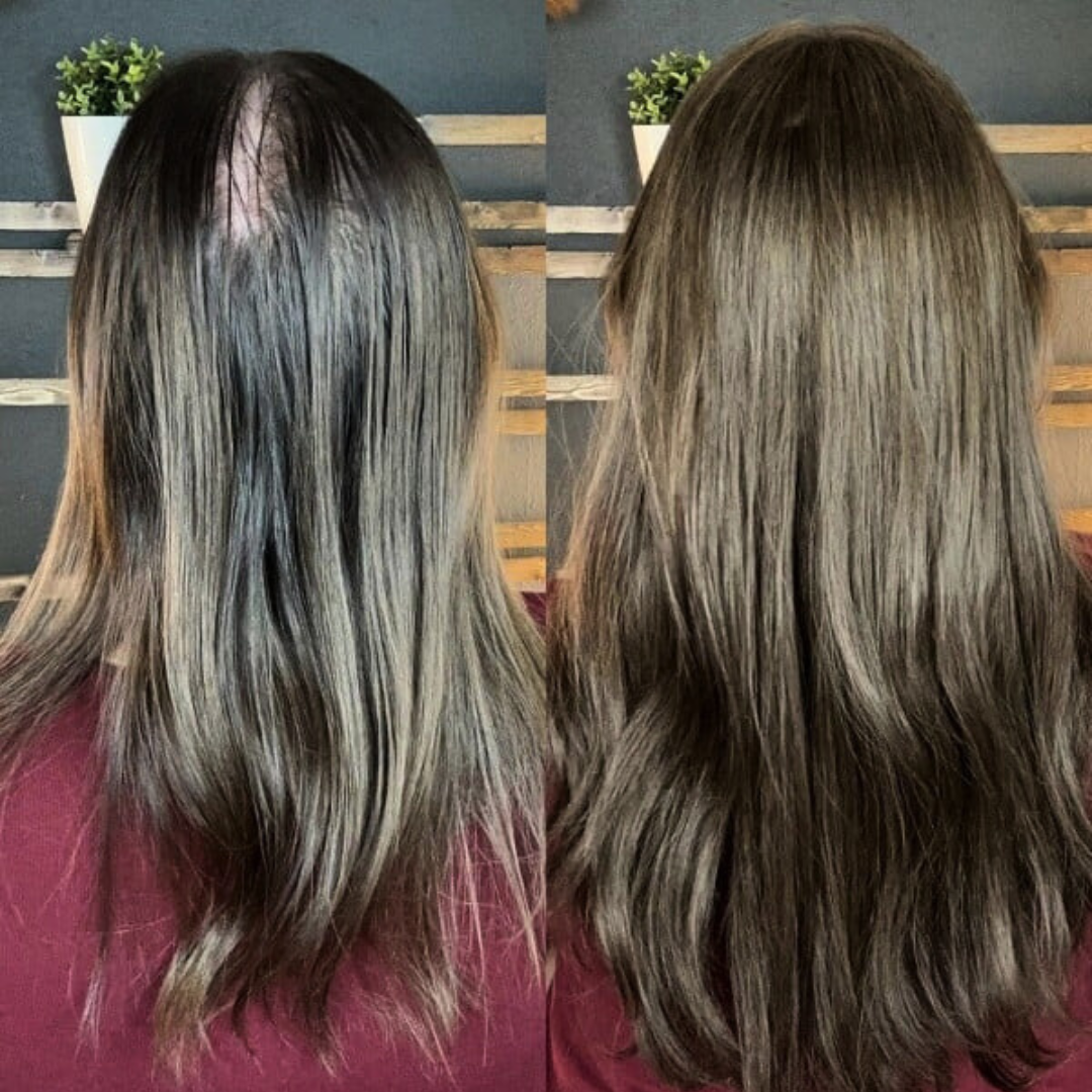 Aplique Topo de Cabeça - Fibra Orgânica (Para Alopecia, Falhas, Cabelos Ralos e com Queda)