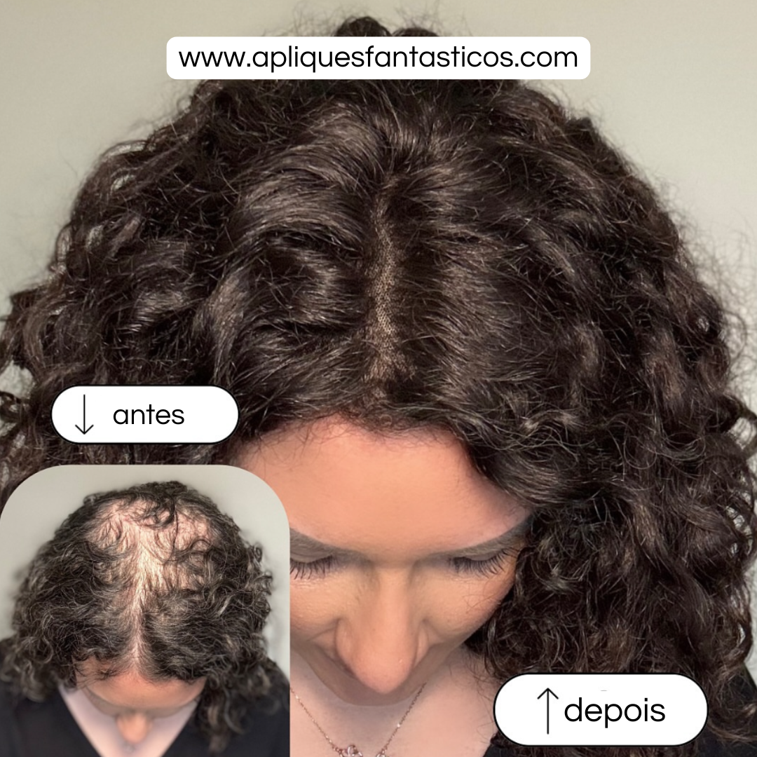 Aplique Topo de Cabeça Cacheado - Fibra Orgânica (Para Alopecia, Falhas, Cabelos Ralos e com Queda)